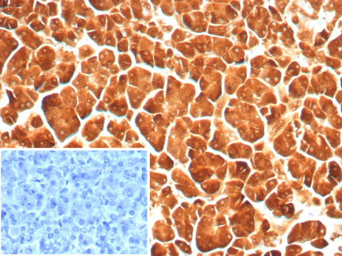 Carboxypeptidase A1/CPA1 Antibody (rCPA1/8689)