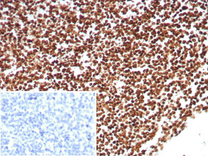 Ku80/XRCC5 Antibody (XRCC5/8703R)