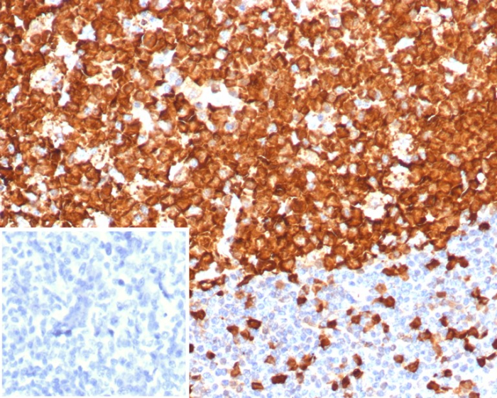 Stathmin 1 Antibody (STMN1/8001R)