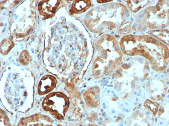 Calbindin D-28K Antibody (rCALB1/8499)
