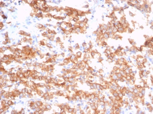 S100 calcium binding protein A14 Antibody (S100A14/7402)