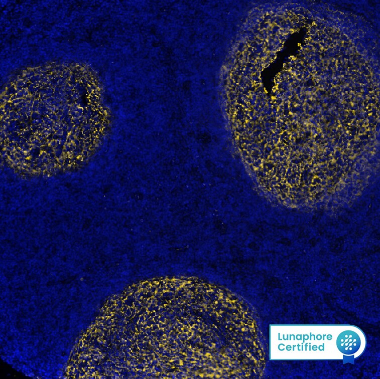 CD21 Antibody (CR2/7185R) CD21 Antibody (CR2/7185R)