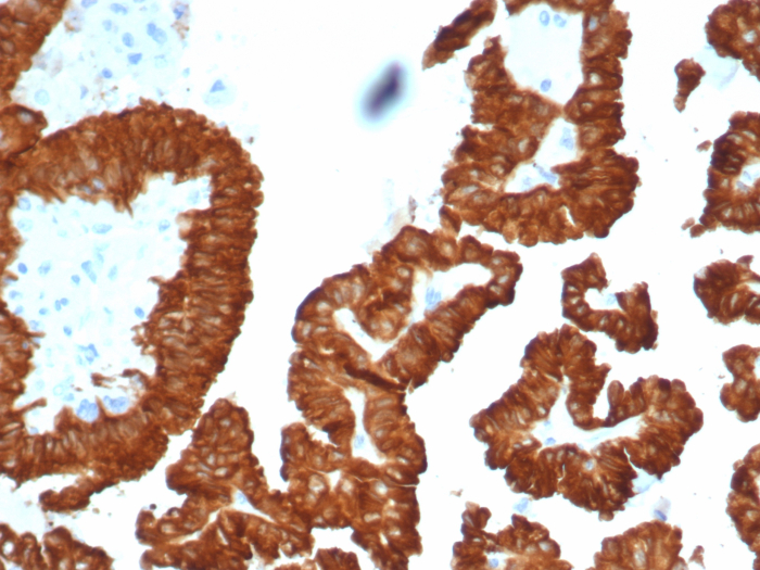AlphaB Crystallin/CRYAB Antibody (CRYAB/4661)