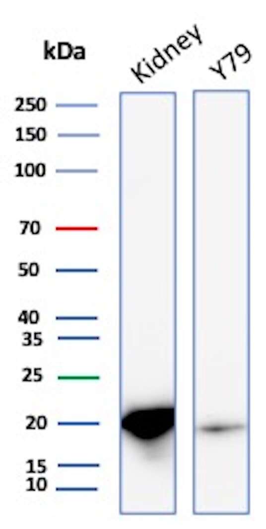 AlphaB Crystallin/CRYAB Antibody (CRYAB/4661) Western Blot: AlphaB Crystallin/CRYAB Antibody (CRYAB/4661) [NBP3-20370] -