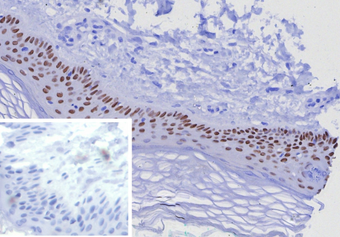 p63/TP73L Antibody (TP63/7807R)
