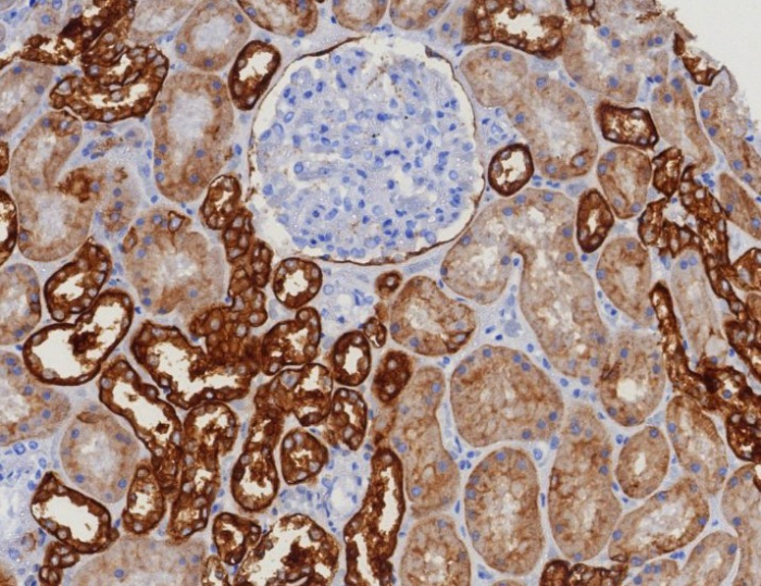 EpCAM/TROP1 Antibody (EGP40/8130R)