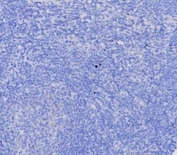 EpCAM/TROP1 Antibody (EGP40/8130R)