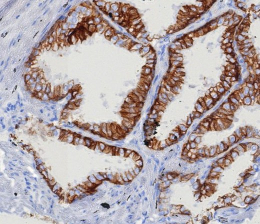 EpCAM/TROP1 Antibody (EGP40/8130R)