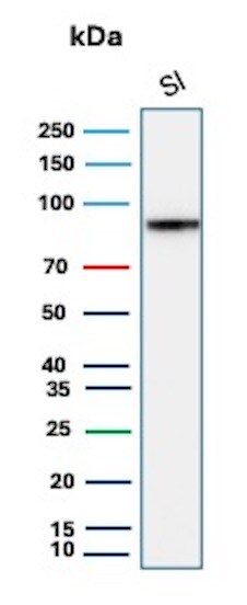 Cadherin-17 Antibody (CDH17/8515R) Western Blot: Cadherin-17 Antibody (CDH17/8515R) [NBP3-20384] -