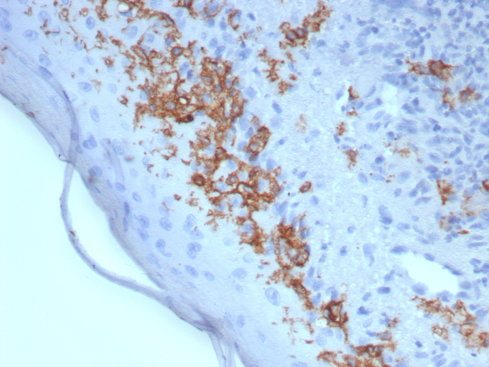 CD1a Antibody (rC1A/8110)