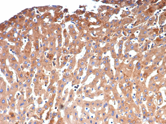 alpha 2-Macroglobulin Antibody (A2M/4848)