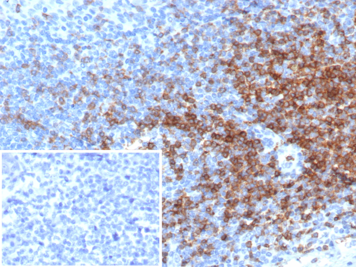 CD3 epsilon Antibody (rC3e/6966)
