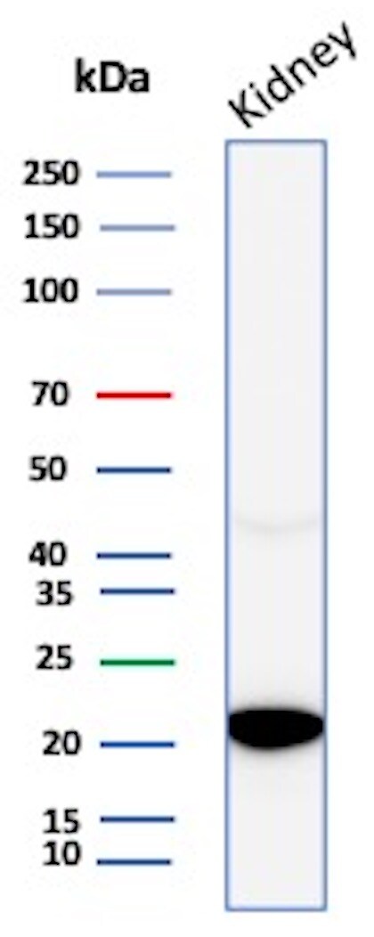 AlphaB Crystallin/CRYAB Antibody (CRYAB/4663) Western Blot: AlphaB Crystallin/CRYAB Antibody (CRYAB/4663) [NBP3-20407] -