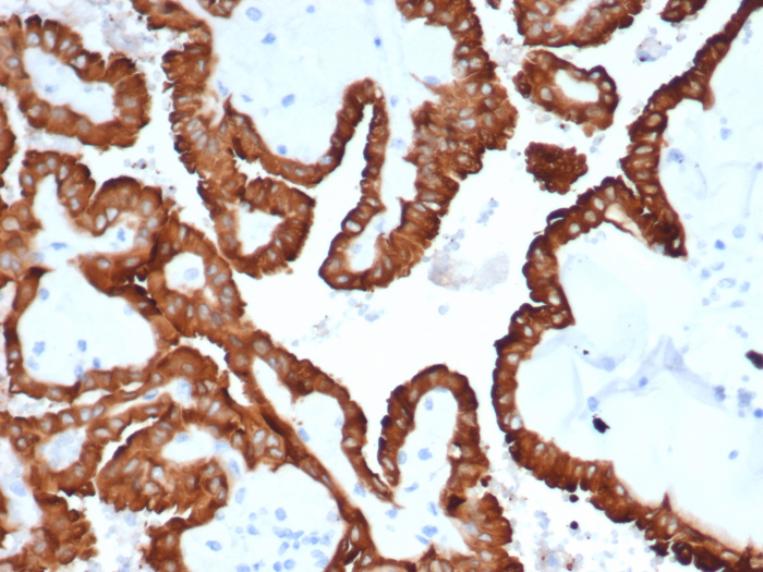 AlphaB Crystallin/CRYAB Antibody (CRYAB/4665)