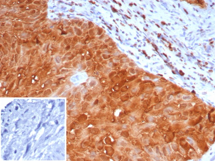 S100P Antibody (S100P/7373) S100P Antibody (S100P/7373) - Azide and BSA Free