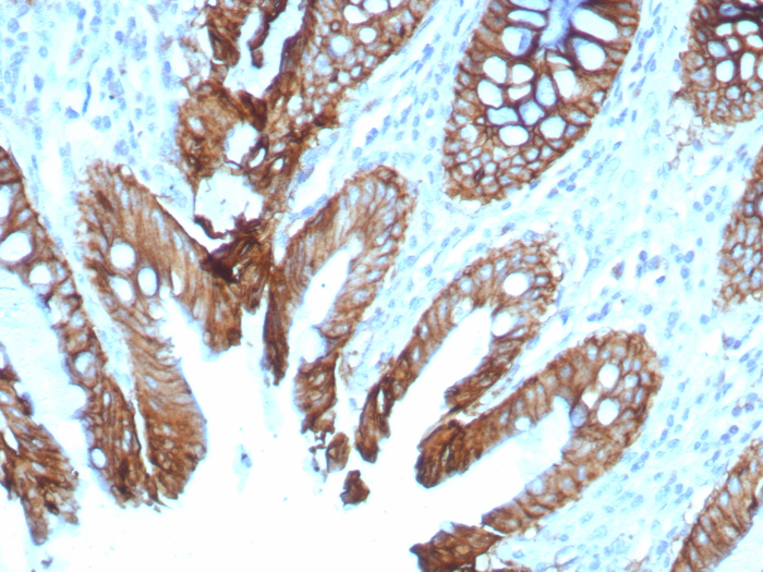 Cadherin-17 Antibody (rCDH17/8512)