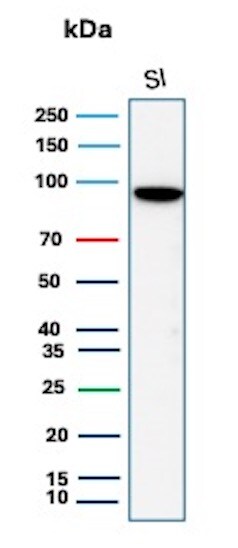 Cadherin-17 Antibody (rCDH17/8514) Western Blot: Cadherin-17 Antibody (rCDH17/8514) [NBP3-20414] -