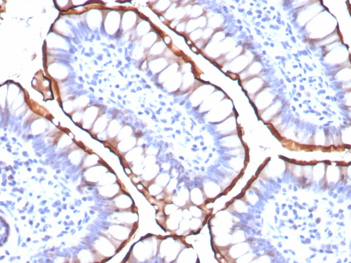 ACE-2 Antibody (ACE2/8748R) ACE-2 Antibody (ACE2/8748R) - Azide and BSA Free