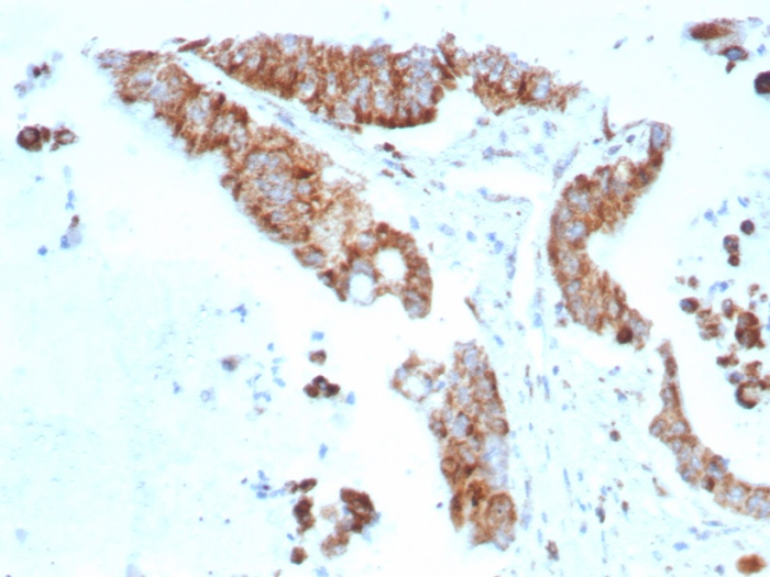 BCMA/TNFRSF17 Antibody (rCD269/8507)