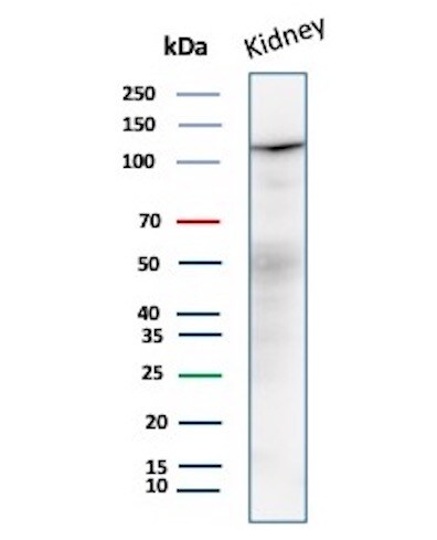 MDM2/HDM2 Antibody (MDM2/7190R) Western Blot: MDM2/HDM2 Antibody (MDM2/7190R) [NBP3-20420] -