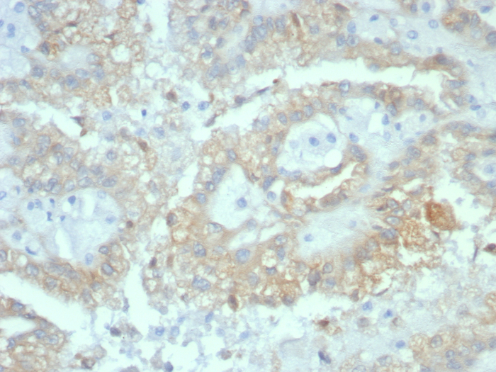 AlphaB Crystallin/CRYAB Antibody (CRYAB/7918)