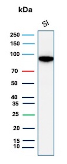Cadherin-17 Antibody (CDH17/8513R) Western Blot: Cadherin-17 Antibody (CDH17/8513R) [NBP3-20428] -