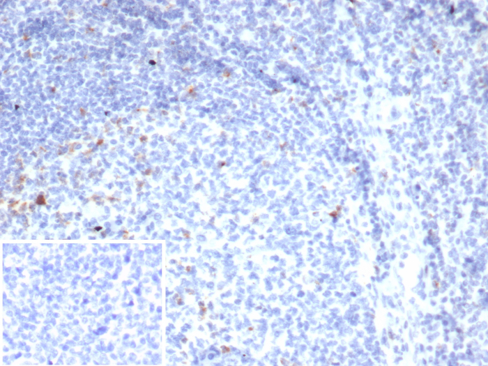 CTLA-4 Antibody (rCTLA4/7219)