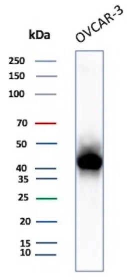 Mesothelin Antibody (rMSLN/8764) Western Blot: Mesothelin Antibody (rMSLN/8764) [NBP3-20432] -