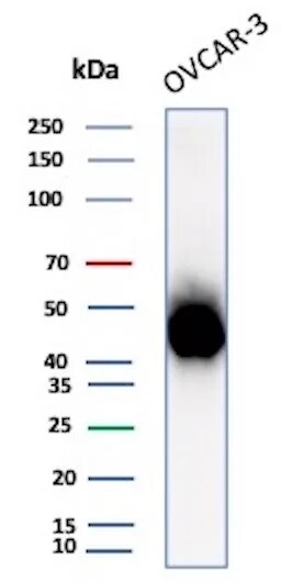 Mesothelin Antibody (MSLN/8391R) Western Blot: Mesothelin Antibody (MSLN/8391R) [NBP3-20436] -