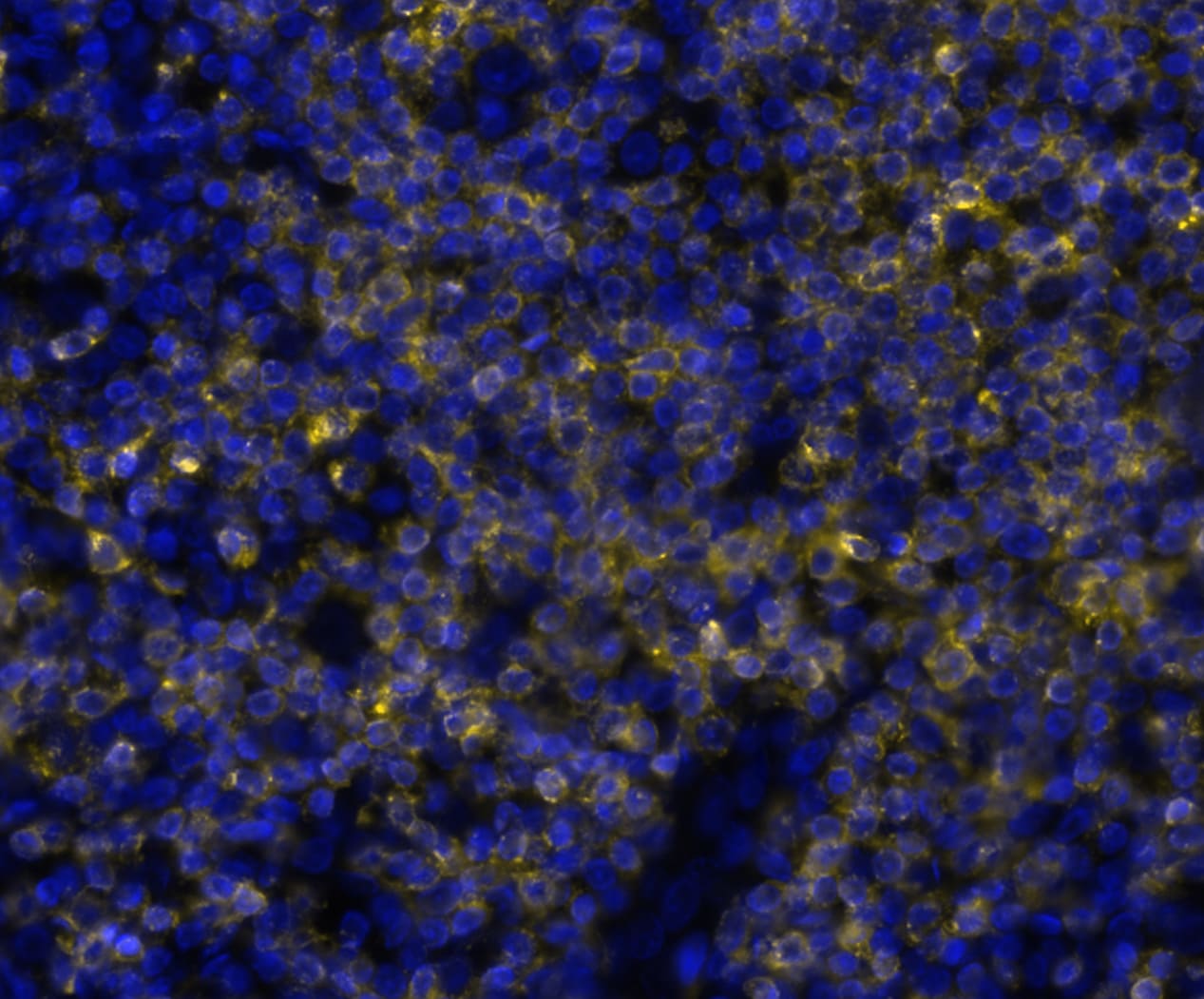 CD7 Antibody (rCD7/6972) Multiplex Immunofluorescence: CD7 Antibody (rCD7/6972) [NBP3-20452]