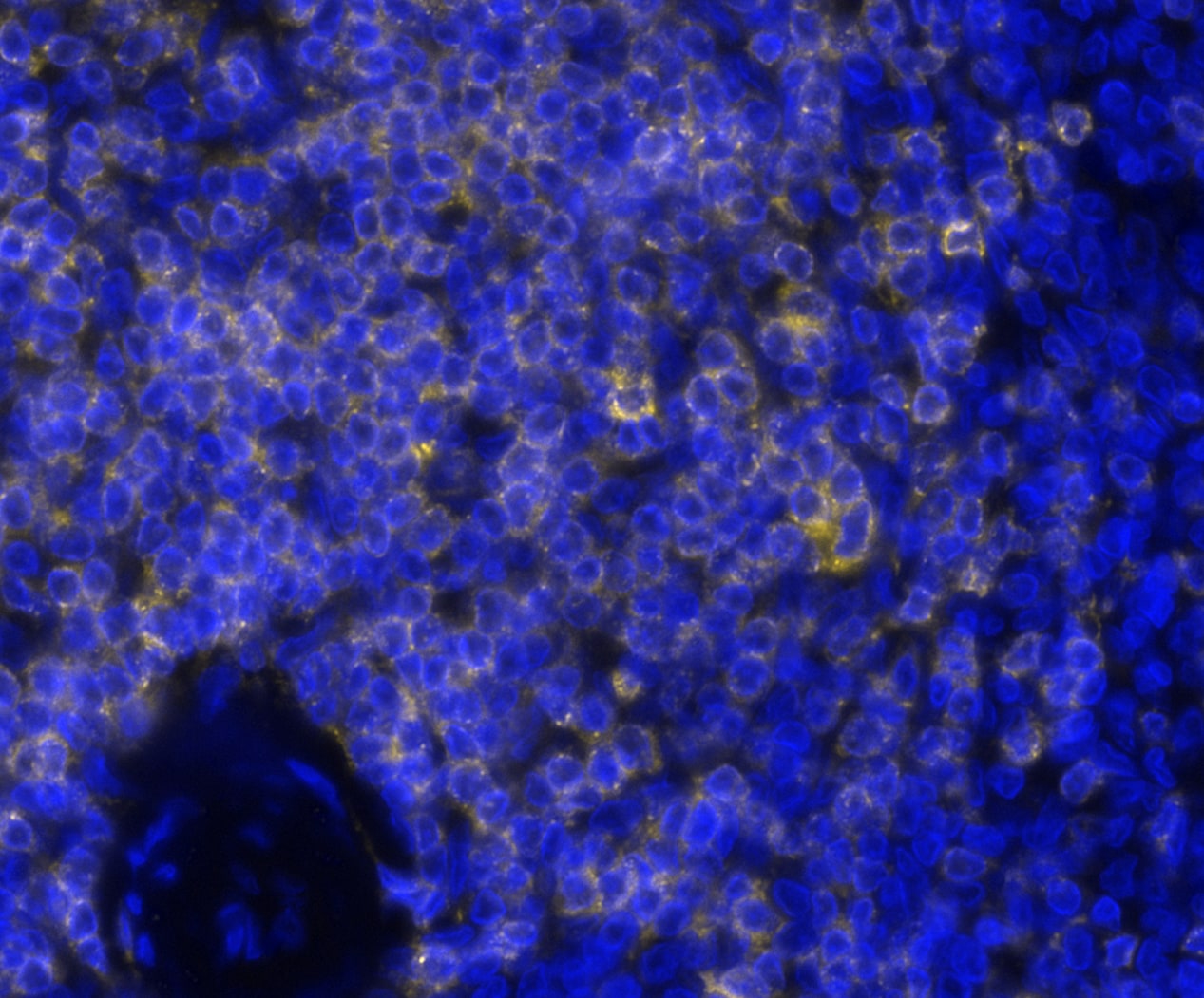 CD7 Antibody (rCD7/6972) Multiplex Immunofluorescence: CD7 Antibody (rCD7/6972) [NBP3-20452]