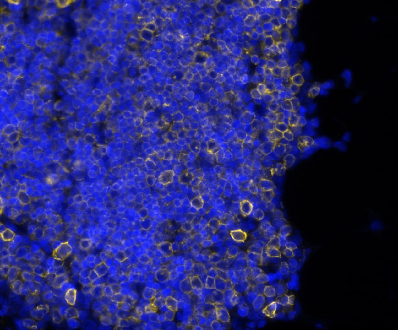 CD7 Antibody (rCD7/6972) Multiplex Immunofluorescence: CD7 Antibody (rCD7/6972) [NBP3-20452]