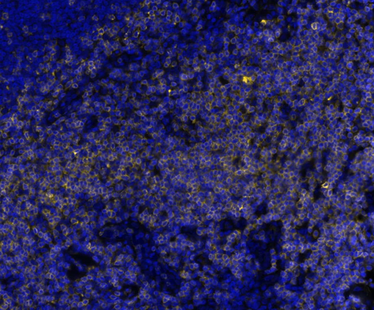 CD7 Antibody (rCD7/6972) Multiplex Immunofluorescence: CD7 Antibody (rCD7/6972) [NBP3-20452]