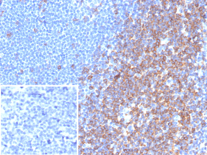 CD7 Antibody (rCD7/6972)