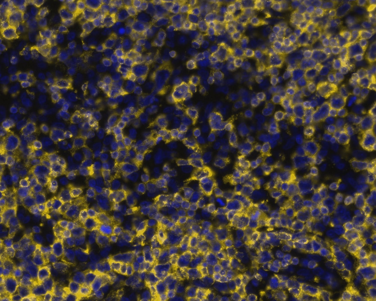 CD7 Antibody (CD7/8118R) CD7 in Human T-Cell Acute LymphoblasticLymphoma via seqIF™ staining on COMET™