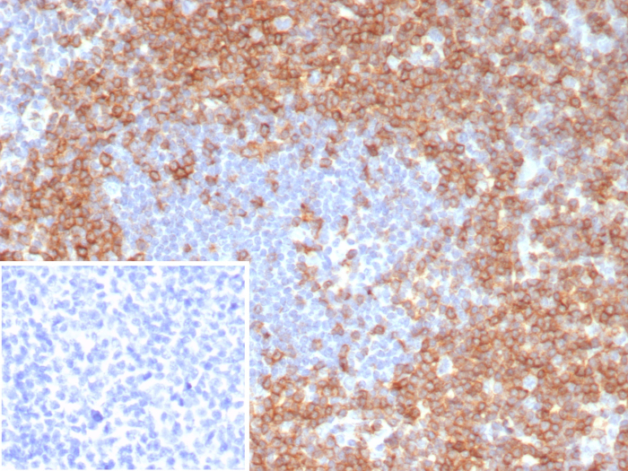 CD7 Antibody (CD7/8118R)
