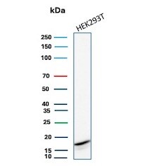 p16INK4a/CDKN2A Antibody (rCDKN2A/8004) Western Blot: p16INK4a/CDKN2A Antibody (rCDKN2A/8004) [NBP3-20460] -