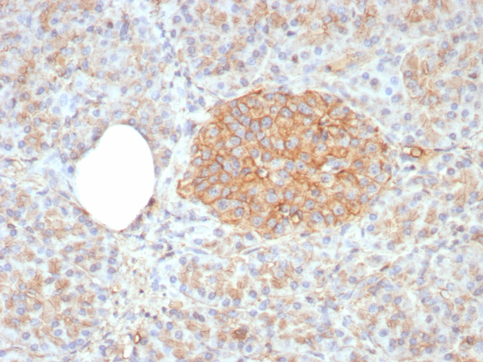 CD99 Antibody (rMIC2/8358)