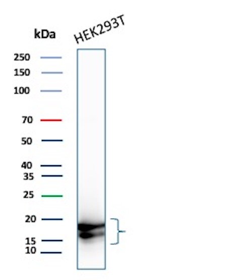 p16INK4a/CDKN2A Antibody (CDKN2A/8223R) Western Blot: p16INK4a/CDKN2A Antibody (CDKN2A/8223R) [NBP3-20466] -