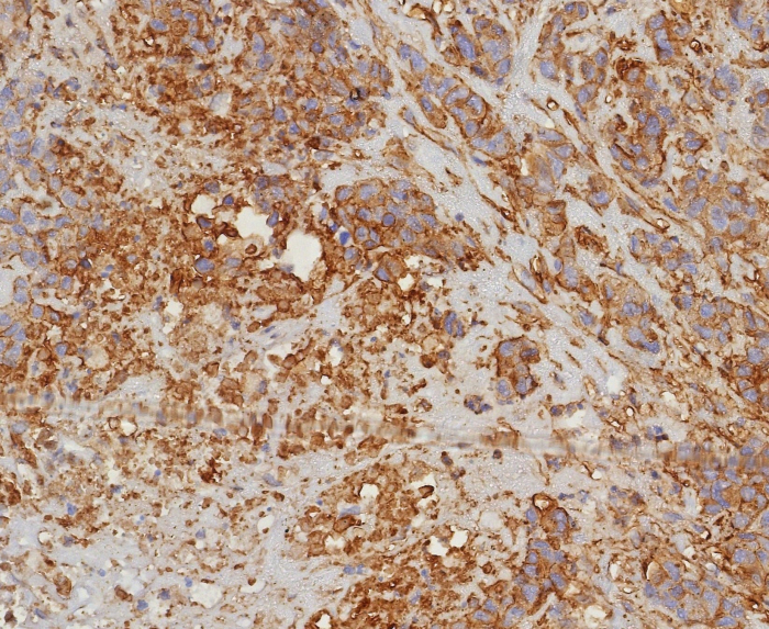 HLA G Antibody (HLAG/8344R)