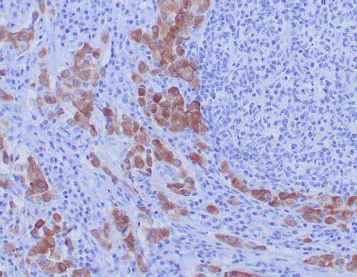 ROS Antibody (ROS1/7999R)