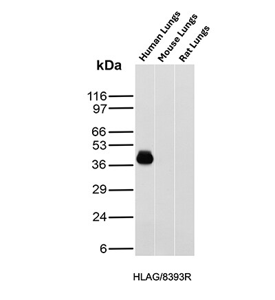 HLA G Antibody (HLAG/8393R) Western Blot: HLA G Antibody (HLAG/8393R) [NBP3-20483] -