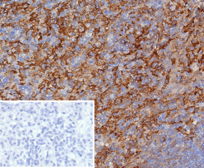 CD163 Antibody (M130/8361R)