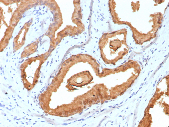 Kallikrein 3/PSA Antibody (rKLK3/6947)