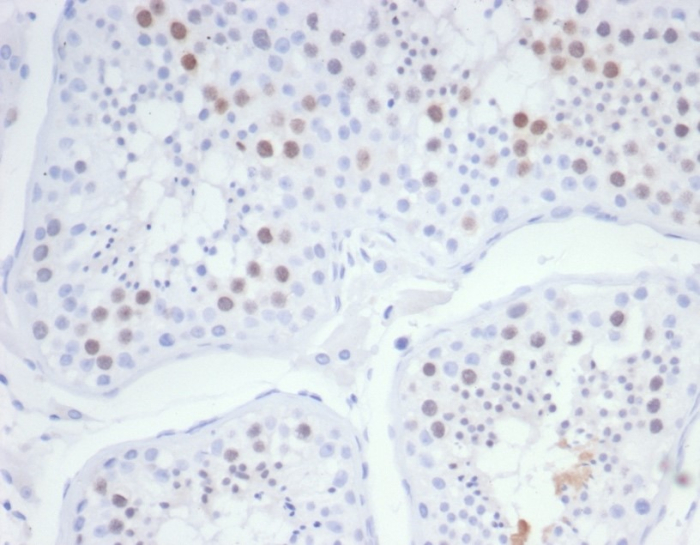KIF2C Antibody (KIF2C/6526)