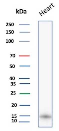 FABP3/H-FABP Antibody (FABP3/8440) Western Blot: FABP3/H-FABP Antibody (FABP3/8440) [NBP3-20507] -