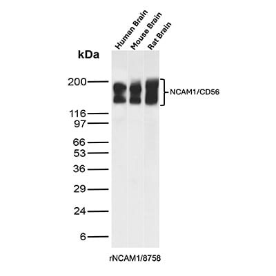 NCAM-1/CD56 Antibody (rNCAM1/8758) Western Blot: NCAM-1/CD56 Antibody (rNCAM1/8758) [NBP3-20518] -