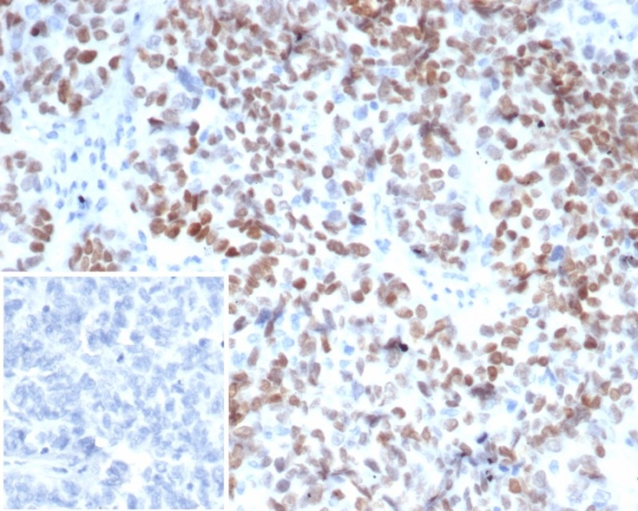 MEIS2 Antibody (PCRP-MEIS2-2B3)
