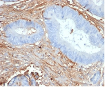 Fibrillin 1 Antibody (FBN1/6933)