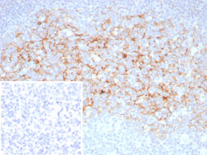 CD23/Fc epsilon RII Antibody (FCER2/8510R)
